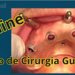 Curso Cirurgia Guiada com Thiago Dinato