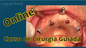 Curso Cirurgia Guiada com Thiago Dinato