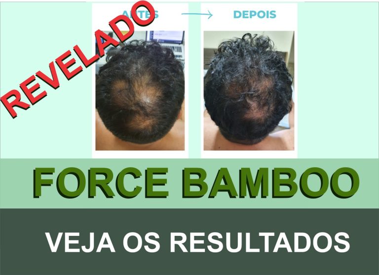 FORCE BAMBOO VEJA OS RESULTADOS CONTRA A QUEDA DE CABELOS